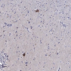 Immunohistochemical staining of human cerebral cortex shows strong cytoplasmic positivity in neuronal cells.