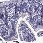 Immunohistochemical staining of human duodenum shows strong cytoplasmic positivity in endocrine glandular cells.