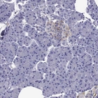Immunohistochemical staining of human pancreas shows moderate cytoplasmic positivity in endocrine glandular cells.