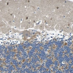 Immunohistochemical staining of human cerebellum shows weak to moderate cytoplasmic positivity in cells in molecular layer.