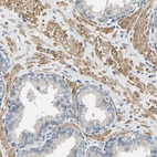 Immunohistochemical staining of human prostate shows moderate cytoplasmic positivity in smooth muscle cells.