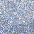 Anti-NEGR1 Antibody