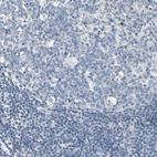 Immunohistochemical staining of human tonsil shows no positivity in germinal center cells as expected.
