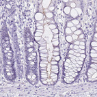 Immunohistochemical staining of human colon shows no positivity in glandular cells as expected.