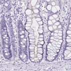 Immunohistochemical staining of human colon shows no positivity in glandular cells as expected.