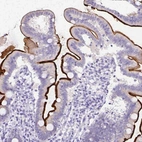 Immunohistochemical staining of human duodenum shows moderate to strong membranous positivity in glandular cells.