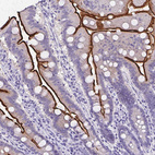 Immunohistochemical staining of human small intestine shows moderate to strong membranous positivity in glandular cells.