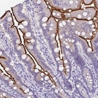 Immunohistochemical staining of human small intestine shows moderate to strong membranous positivity in glandular cells.