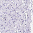 Immunohistochemical staining of human stomach shows no positivity in glandular cells as expected.