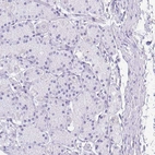 Immunohistochemical staining of human stomach shows no positivity in glandular cells as expected.
