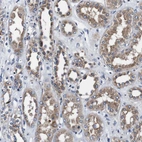 Anti-PDCD6IP Antibody