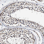 Immunohistochemical staining of human testis shows moderate cytoplasmic positivity in cells in seminiferous ducts.