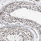 Immunohistochemical staining of human testis shows moderate cytoplasmic positivity in cells in seminiferous ducts.