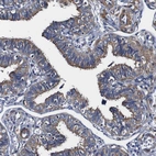 Immunohistochemical staining of human Fallopian tube shows strong cytoplasmic positivity in glandular cells.