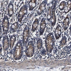 Immunohistochemical staining of human duodenum shows moderate cytoplasmic positivity in glandular cells.