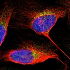 Immunofluorescent staining of human cell line U-2 OS shows localization to cytosol.