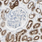 Immunohistochemical staining of human kidney shows moderate to strong cytoplasmic positivity in cells in tubules.