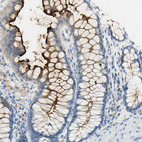 Anti-TSPAN1 Antibody