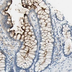 Immunohistochemical staining of human colon shows weak to moderate cytoplasmic positivity in glandular cells.