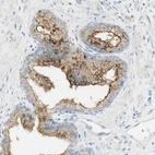 Immunohistochemical staining of human prostate shows moderate to strong cytoplasmic positivity in glandular cells.