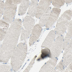 Immunohistochemical staining of human skeletal muscle shows no positivity in myocytes as expected.