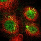 Immunofluorescent staining of human cell line A-431 shows localization to nucleoplasm & vesicles.