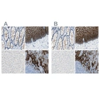 Immunohistochemical staining of human colon, esophagus, liver and tonsil using Anti-DSC2 antibody HPA011911 (A) shows similar protein distribution across tissues to independent antibody HPA012615 (B).