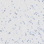 Immunohistochemical staining of human cerebral cortex shows no positivity in neurons as expected.