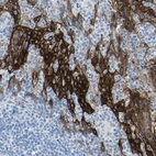 Immunohistochemical staining of human tonsil shows strong membranous positivity in squamous epithelial cells.
