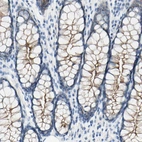 Immunohistochemical staining of human colon shows moderate membranous positivity in glandular cells.