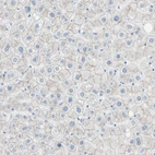 Immunohistochemical staining of human liver shows weak membranous positivity in hepatocytes.