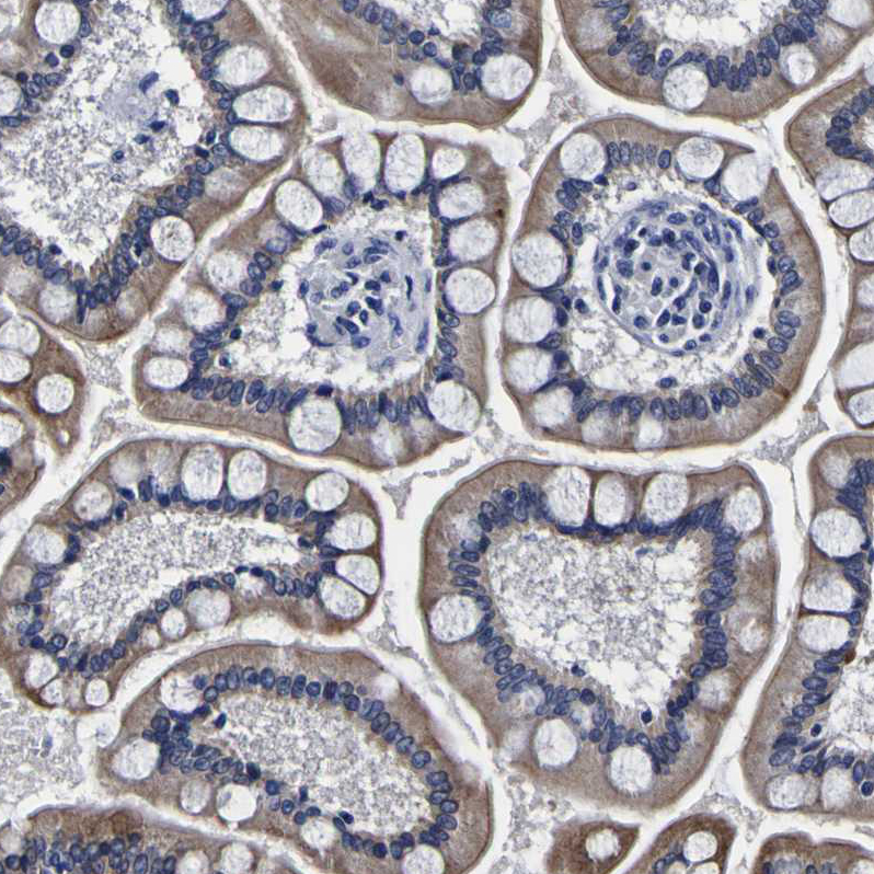 Anti-PDLIM4 Antibody