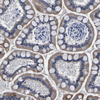 Anti-PDLIM4 Antibody