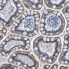 Anti-PDLIM4 Antibody