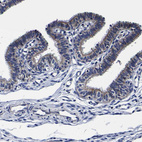 Immunohistochemical staining of human Fallopian tube shows weak to moderate membranous and cytoplasmic positivity in glandular cells.