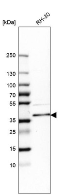 Western blot analysis in human cell line RH-30.