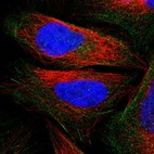 Immunofluorescent staining of human cell line U-2 OS shows localization to actin filaments.