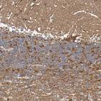 Anti-SYNJ1 Antibody