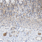Immunohistochemical staining of human rectum shows moderate cytoplasmic positivity in neurons in peripheral ganglia.