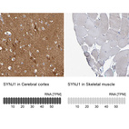 Immunohistochemistry analysis in human cerebral cortex and skeletal muscle tissues using HPA011916 antibody. Corresponding SYNJ1 RNA-seq data are presented for the same tissues.