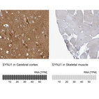 Immunohistochemistry analysis in human cerebral cortex and skeletal muscle tissues using HPA011916 antibody. Corresponding SYNJ1 RNA-seq data are presented for the same tissues.
