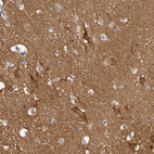 Immunohistochemical staining of human cerebral cortex shows positivity in neuropil as well as moderate to strong cytoplasmic positivity in neurons.