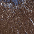Immunohistochemical staining of human Cerebellum shows strong positivity in neuronal processes in neuropil.