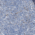 Immunohistochemical staining of human Spleen shows moderate cytoplasmic positivity in cells in red pulp.