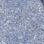 Immunohistochemical staining of human Spleen shows moderate cytoplasmic positivity in cells in red pulp.