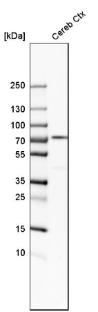 Western blot analysis in human cerebral cortex tissue.
