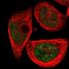 Immunofluorescent staining of human cell line A-431 shows localization to nucleoplasm.