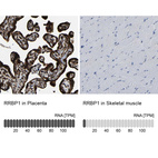 Anti-RRBP1 Antibody