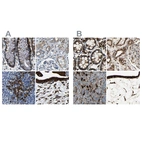 Immunohistochemical staining of human colon, kidney, lymph node and placenta using Anti-RRBP1 antibody HPA011924 (A) shows similar protein distribution across tissues to independent antibody HPA009026 (B).