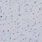Immunohistochemical staining of human skeletal muscle shows low expression as expected.